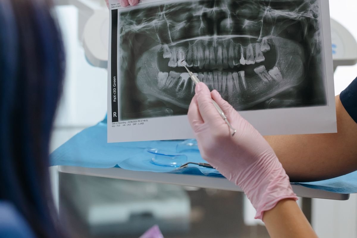 Dentista analisando uma radiografia panorâmica para tratamento de canal